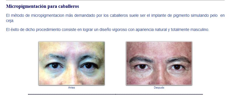 Masculina antes/después