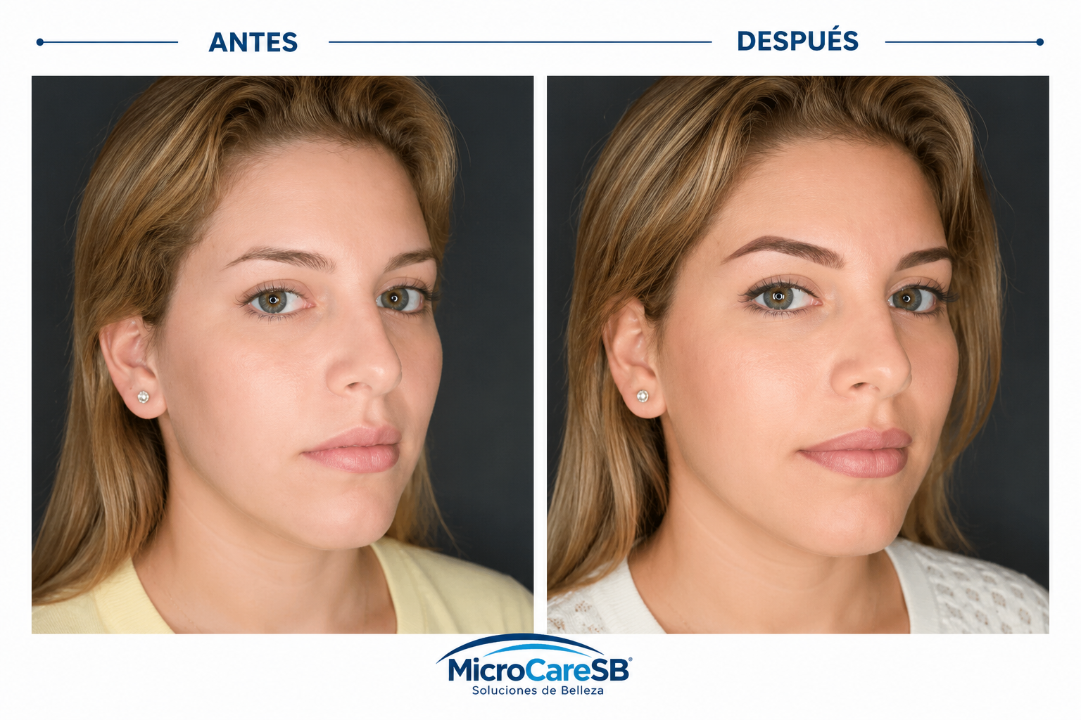 Rostro completo