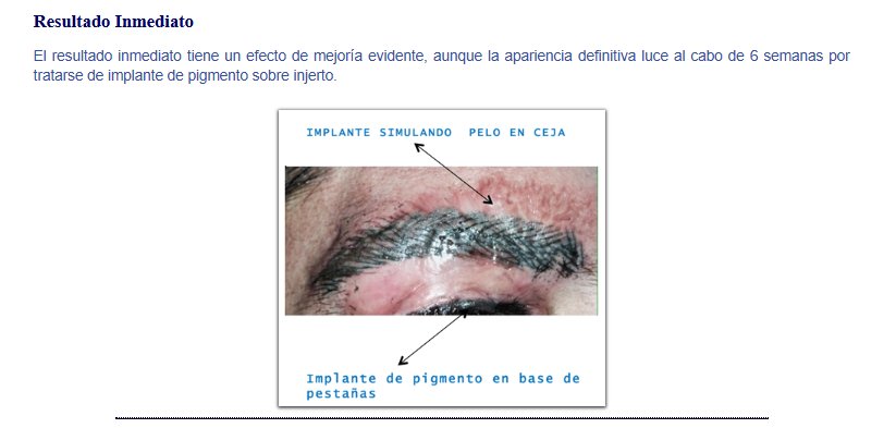 Resultado inmediato